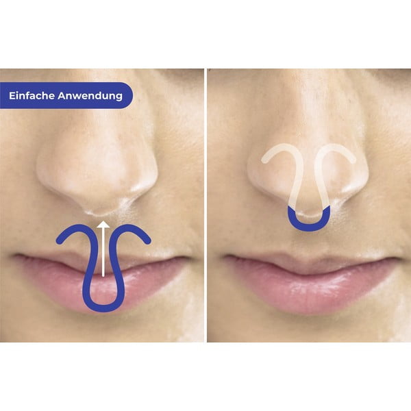 Clip antirussamento in set di 3 pezzi - Maximex-image-1