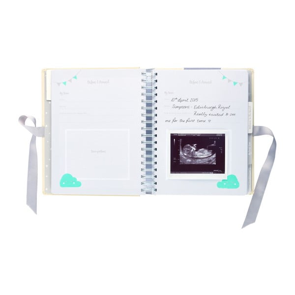 Diario di gravidanza Diario di gravidanza - Busy B-image-4